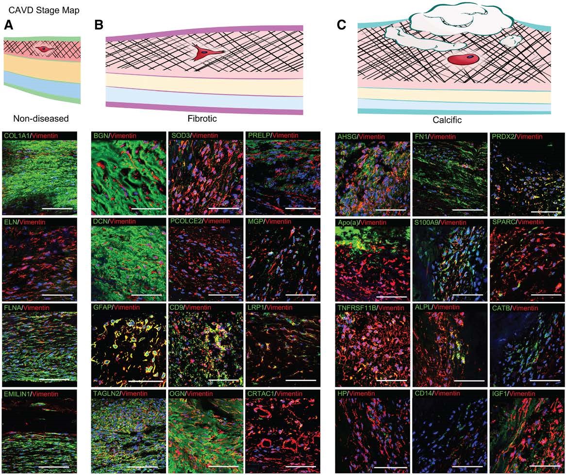 Spatiotemporal%20Multi-Omics%20Mapping%20Generates%20a%20Mol%206252042e00de408ba75fcd3a8677da57/CIRCULATIONAHA.117.1.jpg