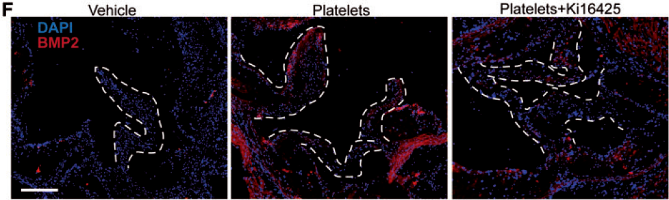 Activated%20platelets%20promote%20an%20osteogenic%20programm%20255b6a1b03bc4734b13a4e94a7841018/Untitled%2032.png