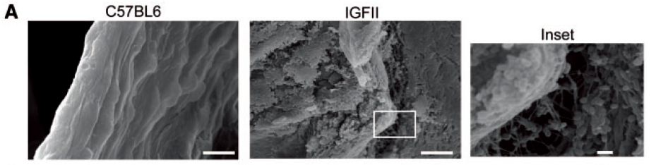 Activated%20platelets%20promote%20an%20osteogenic%20programm%20255b6a1b03bc4734b13a4e94a7841018/Untitled%2026.png